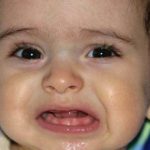 Аллергия при прорезывании зубов: может ли быть, симптомы и что делать