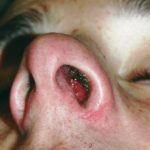 Отек слизистой носа при аллергии: причины и что делать
